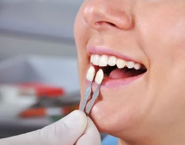 CDCwebsite2024_restorative_crowns